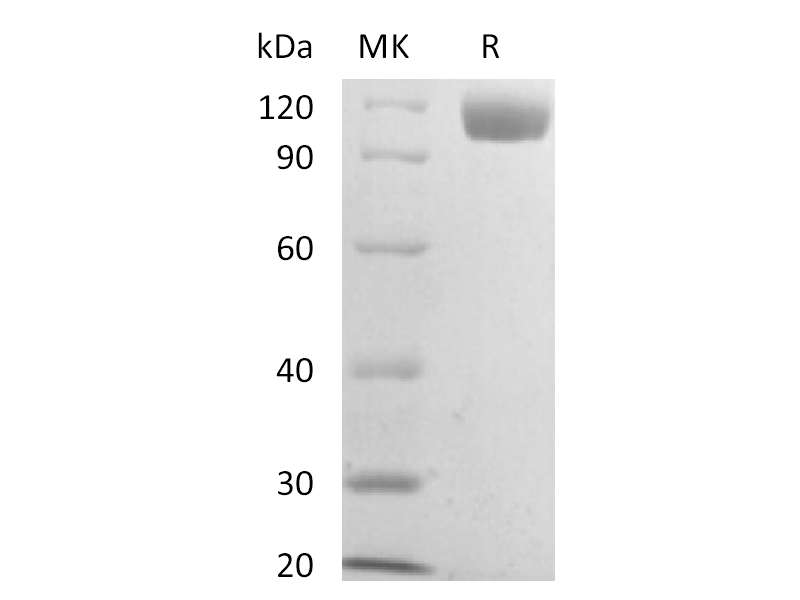Recombinant Mouse Siglec-2 (C-6His)