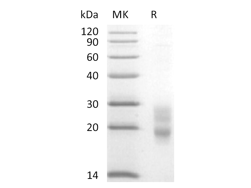 Recombinant Mouse CD7 (C-6His)