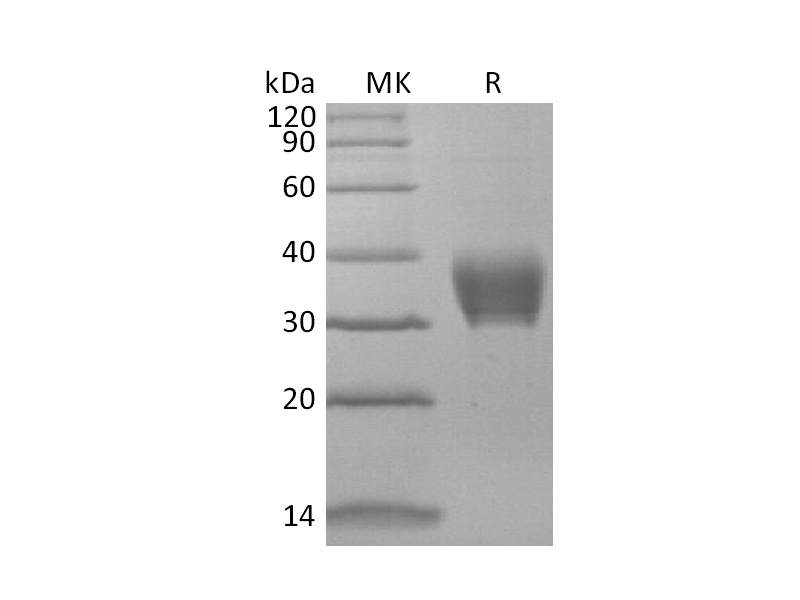 Recombinant Mouse BTNL4 (C-6His)