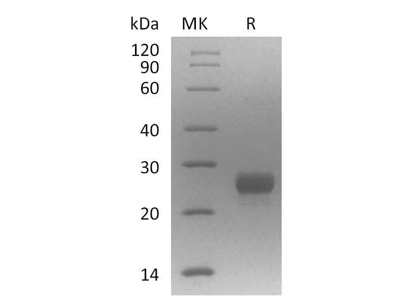 Recombinant Mouse RANK L V2