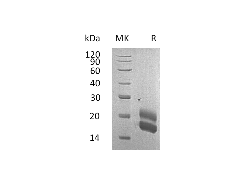 Recombinant Rat GM-CSF (C-6His)