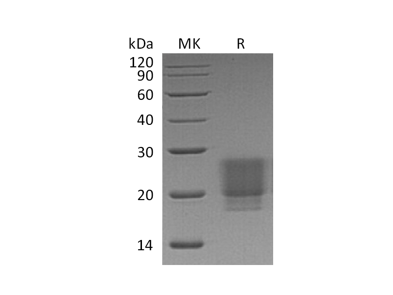 Recombinant Human/Mouse/Rat Irisin (C-6His)
