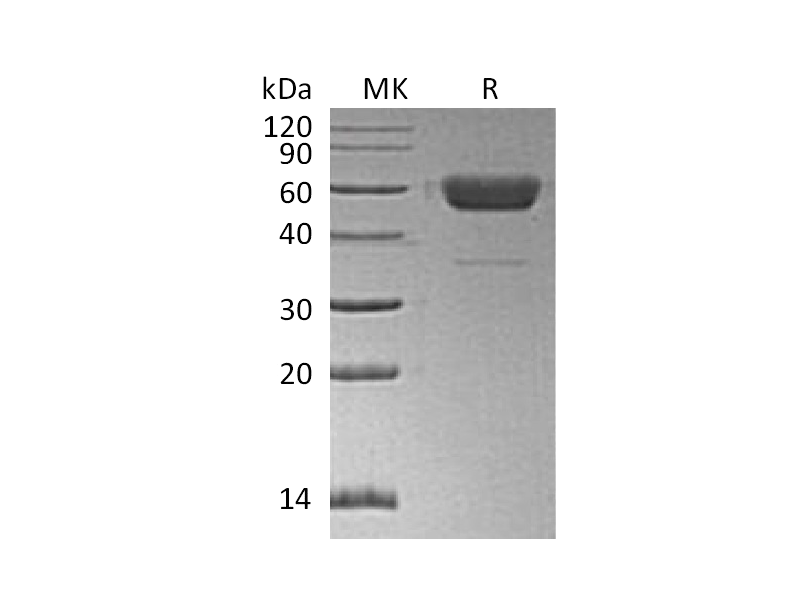 Recombinant Human/Mouse/Rat Irisin (C-Fc)