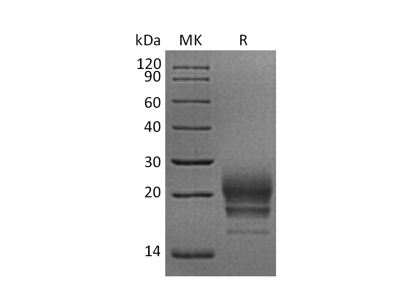 Recombinant Rhesus Macaque CD160 (C-6His)