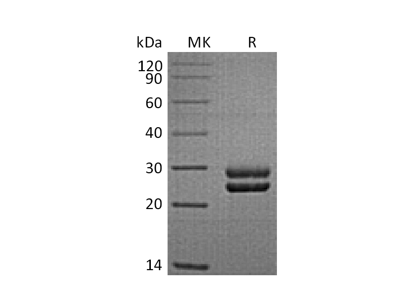 Recombinant Sheep PRL (C-6His)