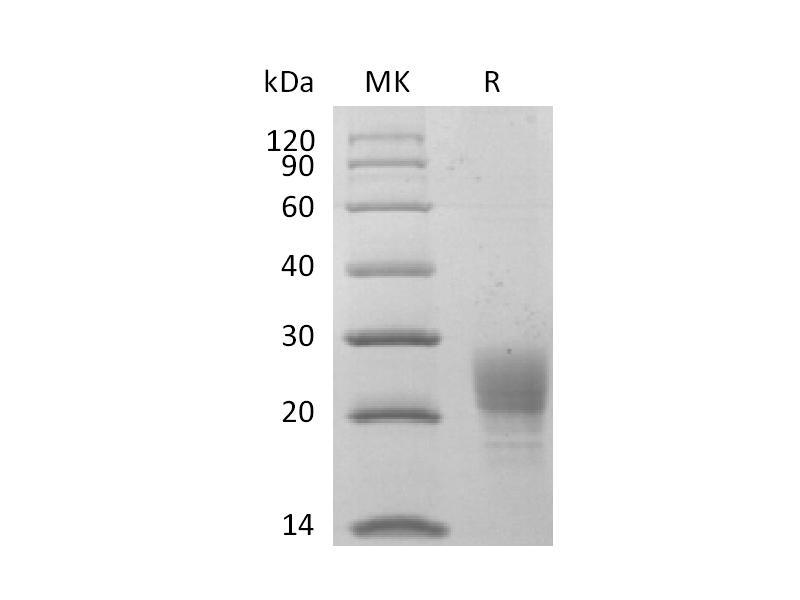 Recombinant Cynomolgus PVRIG (C-6His)