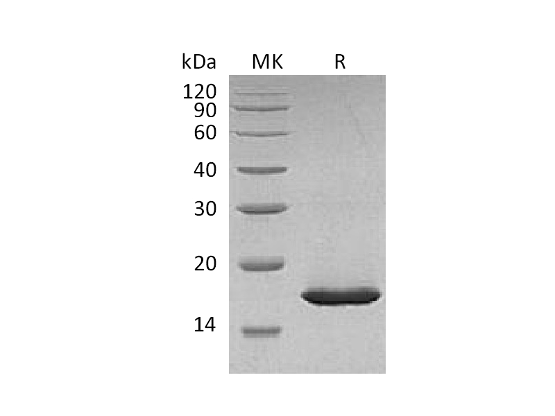 Recombinant Carassiusauratus Leptin (N-8His)