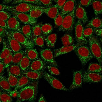 Podocalyxin Antibody / PODXL