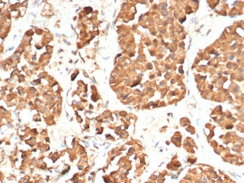 IHC staining of FFPE human pituitary gland tissue with ACTH antibody (clone CLIP/7197R). HIER: boil