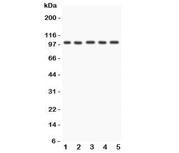 Western blot testing of FGFR4 antibody and Lane 1: HeLa; 2: PANC; 3: SGC; 4: COLO320; 5: SW620; Obse