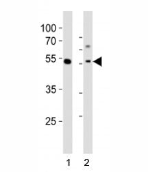 Western blot analysis of lysate from 1) human MCF-7 cell line and 2) mouse liver tissue tissue using