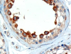 ALMS1 Antibody