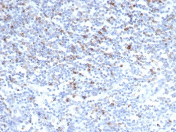 IHC staining of FFPE human tonsil tissue with CD152 antibody (clone CTLA4/6868R). HIER: boil tissue