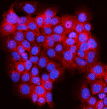 Immunofluorescent staining of FFPE human A431 cells with JLP antibody (red) and DAPI nuclear stain (
