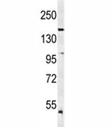 KDR Antibody