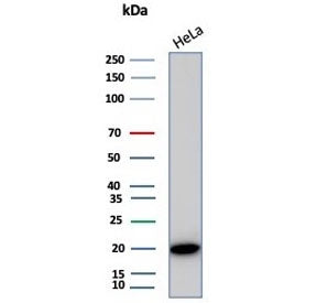 Alpha B Crystallin Antibody / CRYAB