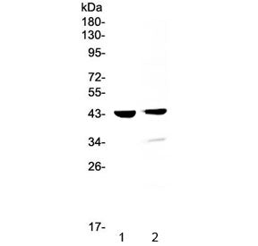 CTSD Antibody / Cathepsin D