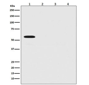 Firefly Luciferase Antibody