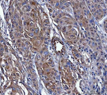 Dicer Antibody