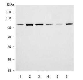 EAG1 Antibody / KCNH1
