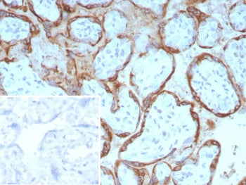 EBI3 Antibody / Epstein-Barr virus induced 3