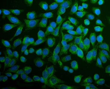ERp5 Antibody / Endoplasmic reticulum protein 5 / PDIA6