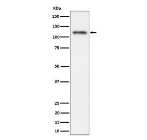 Western blot testing of human SH-SY5Y cell lysate with SEMA4D antibody. Predicted molecular weight ~