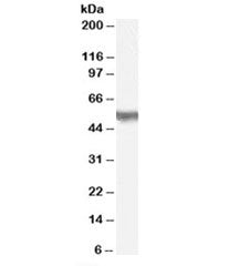 Western blot testing of H460 lysate with PACSIN3 antibody at 1ug/ml. Predicted molecular weight: ~48