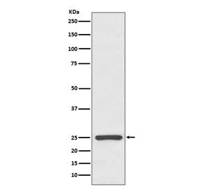 Kappa Light Chain Antibody