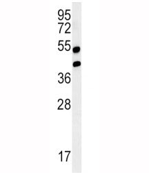 RAGE Antibody