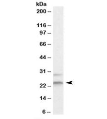 MAD2L1 Antibody