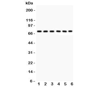 Western blot testing of Kininogen 1 antibody and human samples 1: U87; 2: MCF-7; 3: SKOV; 4: SW620;