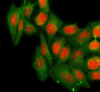 NTHL1 Antibody / NTH1 / Endonuclease III-like protein 1
