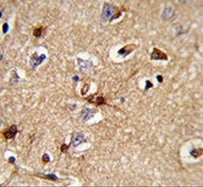 Peroxiredoxin 6 Antibody / PRDX6 / aiPLA2