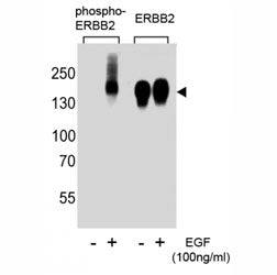 Phospho-ERBB2 Antibody (pY1139)