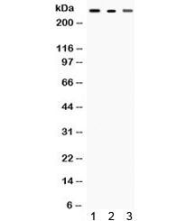 Talin 2 Antibody / TLN2