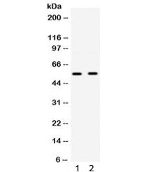 GLUT9 Antibody / Glucose Transporter 9