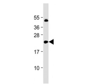 IL-11 Antibody (N-Terminal Region)