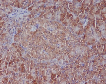 GRP78 Antibody / BiP / HSPA5