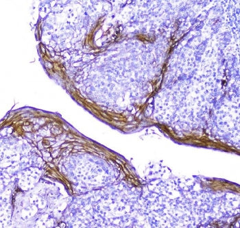 IHC testing of FFEP human tonsil tissue with Periplakin antibody. Required HIER: steam section in pH