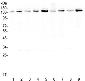 Western blot testing of human 1) HeLa, 2) 22RV1, 3) A431, 4) HepG2, 5) HepG2, 6) SGC-7901, 7) A549,