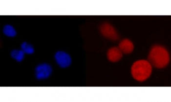 Immunofluorescent staining of FFPE human Caco-2 cells with Poly(rC)-binding protein 2 antibody (red)