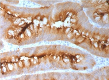 CEA Antibody / Carcinoembryonic Antigen