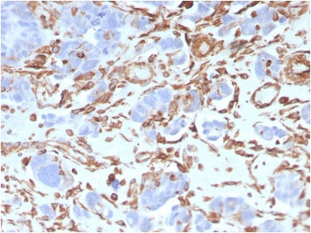Vimentin Antibody