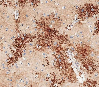 OTUD3 Antibody