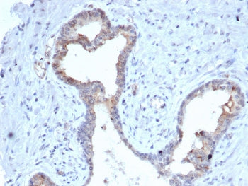 S100A5 Antibody