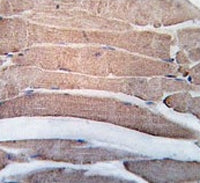 DAPK2 Antibody