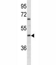ABO Antibody