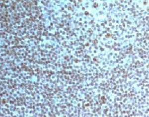 IHC testing of Nucleoli Marker antibody and FFPE human tonsil tissue. HIER: boil tissue sections in