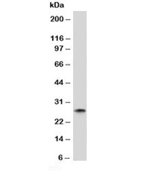 Kappa Light Chain Antibody